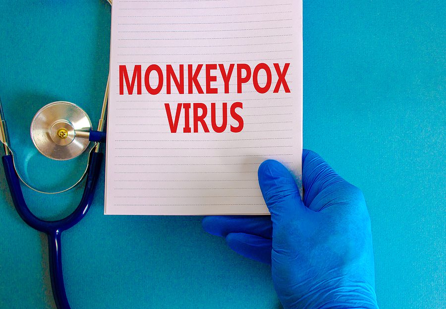 monkeypox concept. a gloved hand holds a note that says monkeypox virus in bold red letters with a stethoscope next to it.