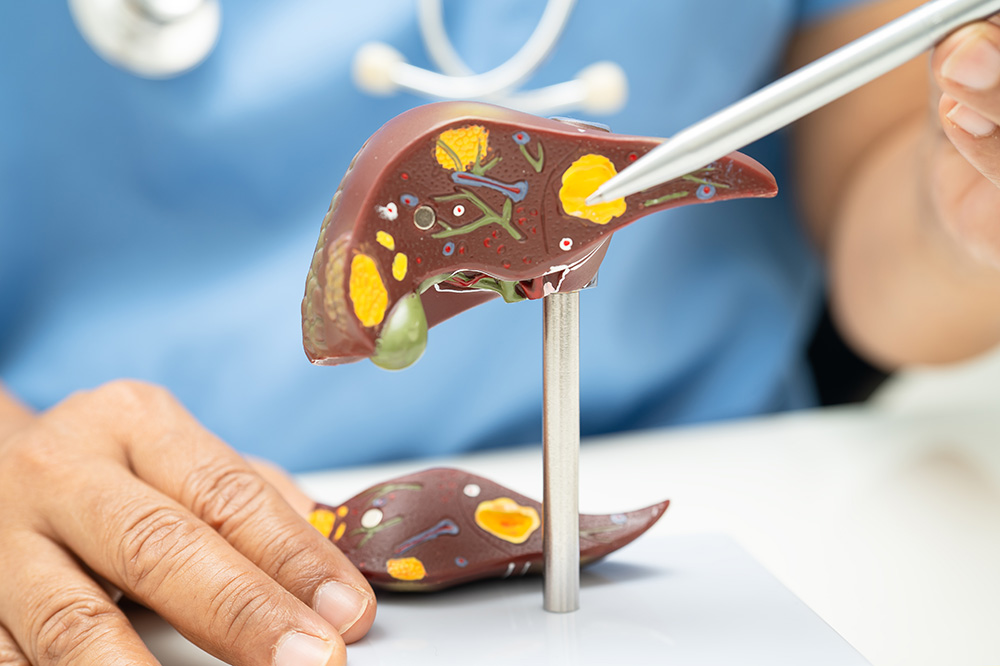 anatomical liver model with doctor pointing at it - liver cancer concept